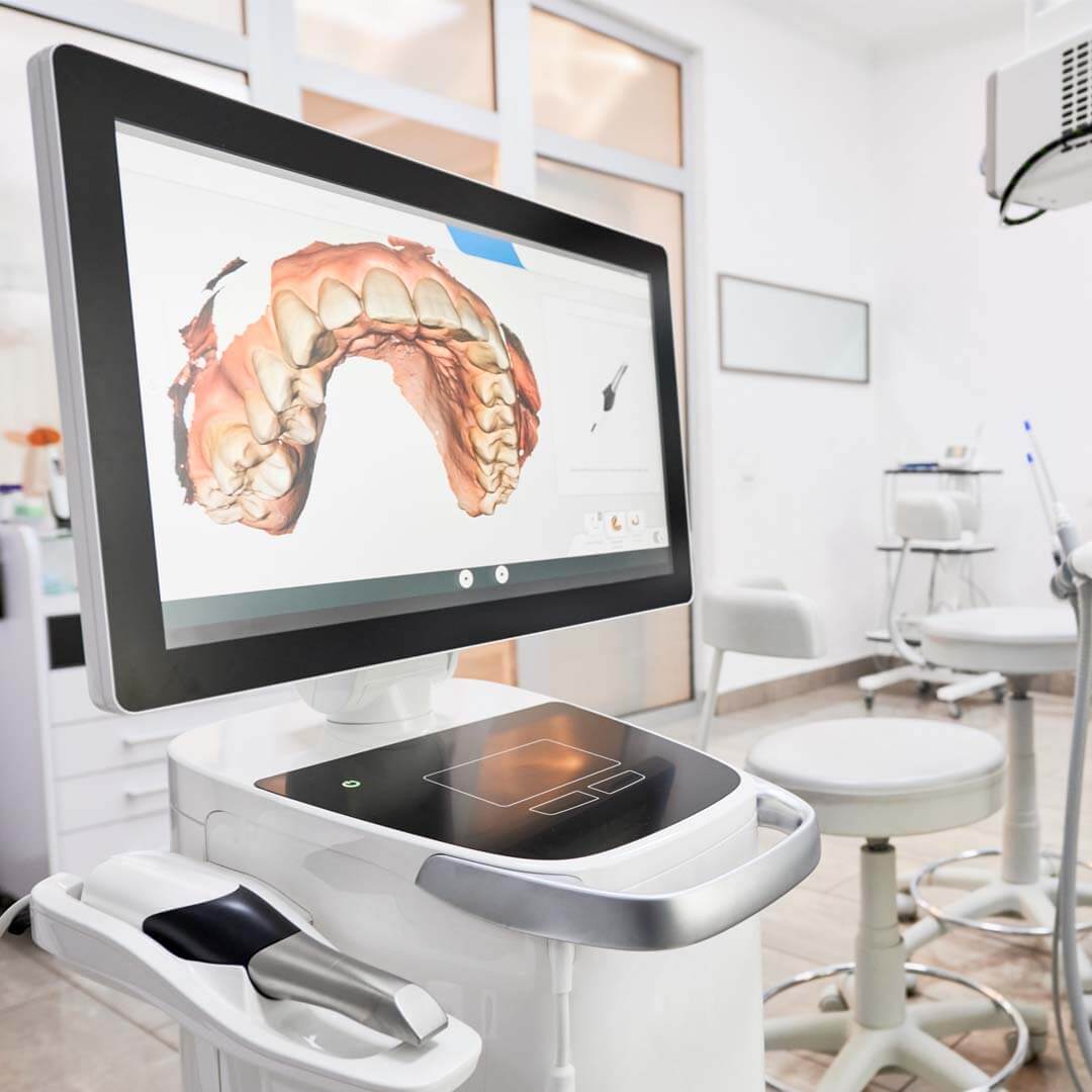 Intra Oral Scanners in Haryana